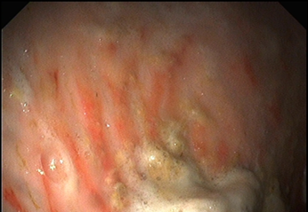 East Kent Gast Clinic